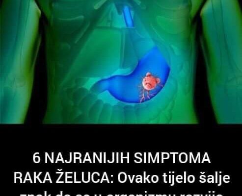 6 NAJRANIJIH SIMPTOMA RAKA ŽELUCA: Ovako tijelo šalje znak da se u organizmu razvija opaki tumor!