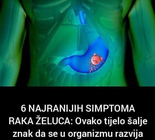 6 NAJRANIJIH SIMPTOMA RAKA ŽELUCA: Ovako tijelo šalje znak da se u organizmu razvija opaki tumor!