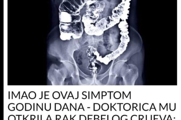 IMAO JE OVAJ SIMPTOM GODINU DANA – DOKTORICA MU OTKRILA RAK DEBELOG CRIJEVA: Upozorenje za sve, ako osjetite ove simptome NE IGNORIŠITE IH