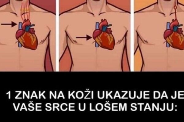 1 ZNAK NA KOŽI UKAZUJE DA JE VAŠE SRCE U LOŠEM STANJU: Obratite pažnju, ako ovo primijetite javite se doktoru