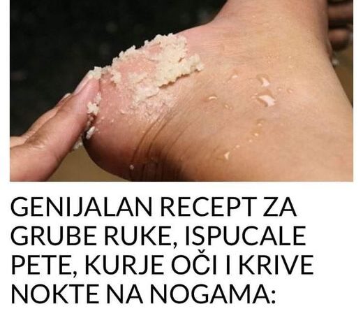 GENIJALAN RECEPT ZA GRUBE RUKE, ISPUCALE PETE, KURJE OČI I KRIVE NOKTE NA NOGAMA: Obavezno zapišite, nećete se pokajati