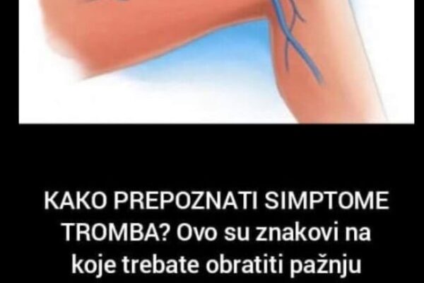 KAKO PREPOZNATI SIMPTOME TROMBA? Ovo su znakovi na koje trebate obratiti pažnju: Kada se krvni ugrušak nađe u blizini srca javljaju se sljedeći simptomi