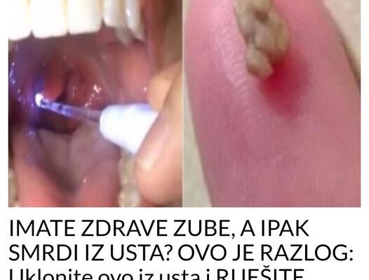 IMATE ZDRAVE ZUBE, A IPAK SMRDI IZ USTA? OVO JE RAZLOG: Uklonite ovo iz usta i RIJEŠITE PROBLEM!