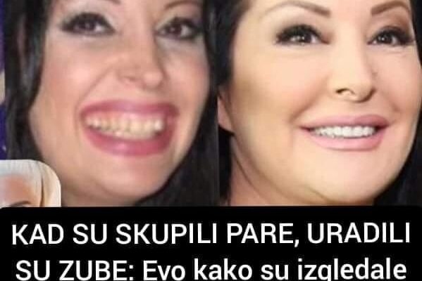 KAD SU SKUPILI PARE, URADILI SU ZUBE: Pogledajte poznate ličnosti prije vještačkih zuba, CECA I JELENA SU NAJVEĆE IZNENAĐENJE (FOTO)