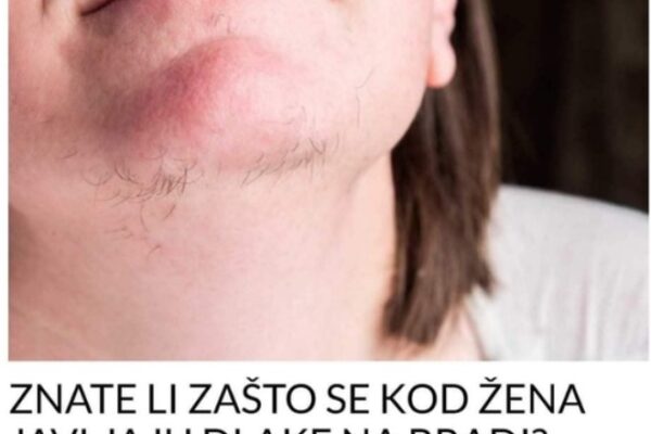 ZNATE LI ZAŠTO SE KOD ŽENA JAVLJAJU DLAKE NA BRADI? Ovako vas organizam upozorava