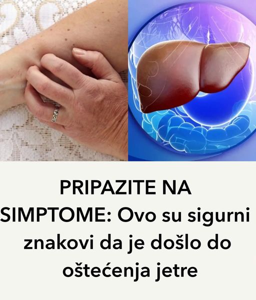 PRIPAZITE NA SIMPTOME: Ovo su sigurni znakovi da je došlo do oštećenja jetre