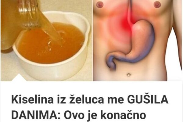 Kiselina iz želuca me GUŠILA DANIMA: Ovo je konačno riješilo moj problem