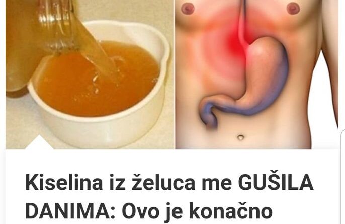 Kiselina iz želuca me GUŠILA DANIMA: Ovo je konačno riješilo moj problem