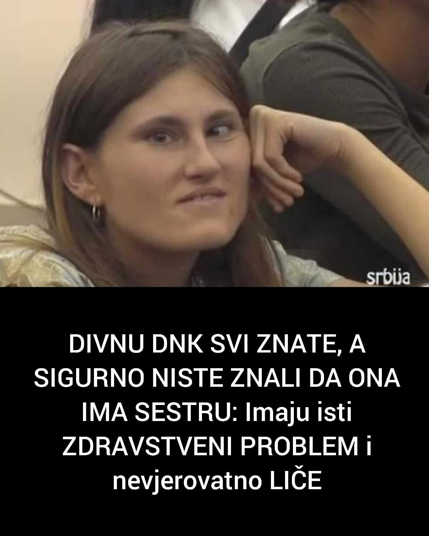 DIVNU DNK SVI ZNATE, A SIGURNO NISTE ZNALI DA ONA IMA SESTRU: Imaju isti ZDRAVSTVENI PROBLEM i nevjerovatno LIČE